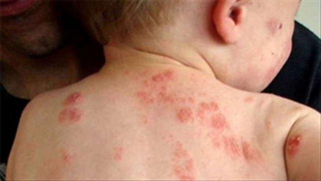 Review Dr For Hair Phyto Therapy Baby