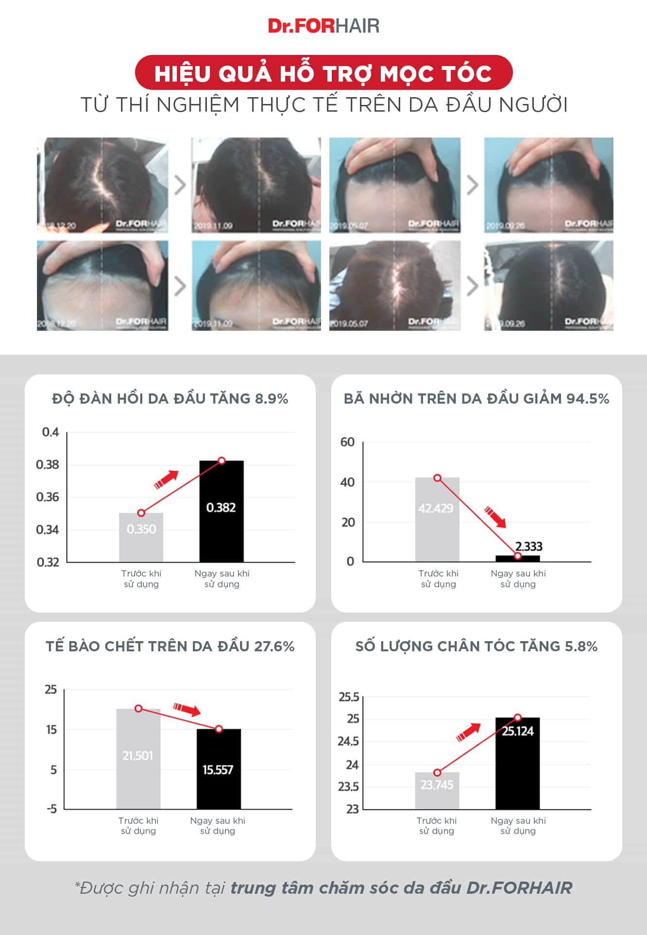Hiệu quả được kiểm nghiệm rõ ràng tại các Viện nghiên cứu của Dr.FORHAIR và thế giới