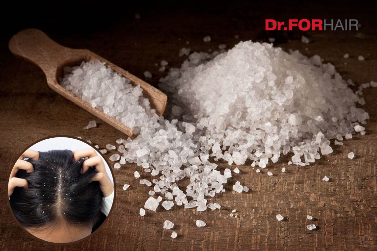 Trị gàu bằng muối hạt