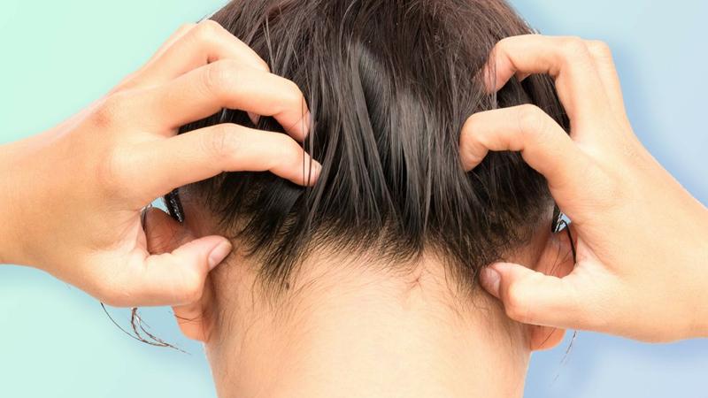 Da đầu nhạy cảm rất dễ kích ứng, ngứa ngáy
