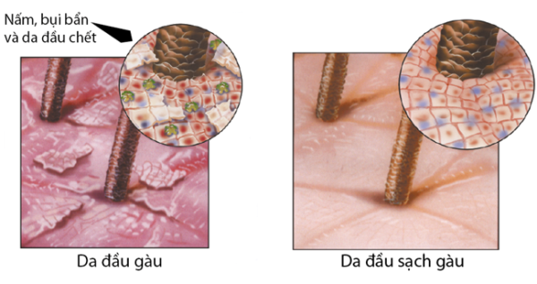 Silicone là gì - Silicone trong dầu gội 