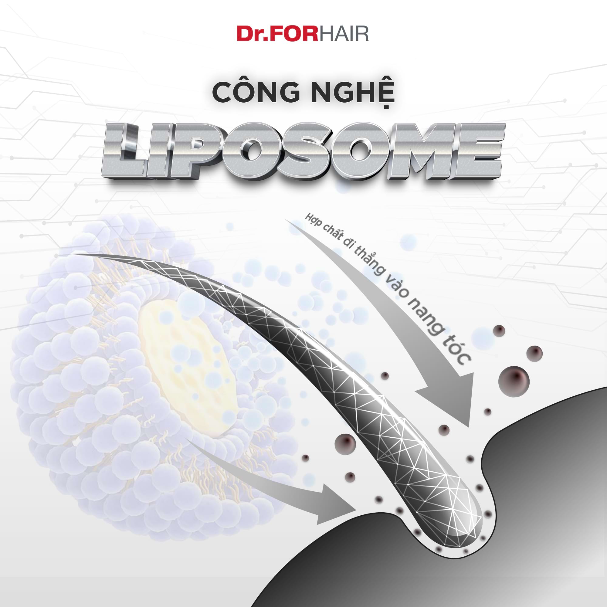 hói đầu ở nam giới