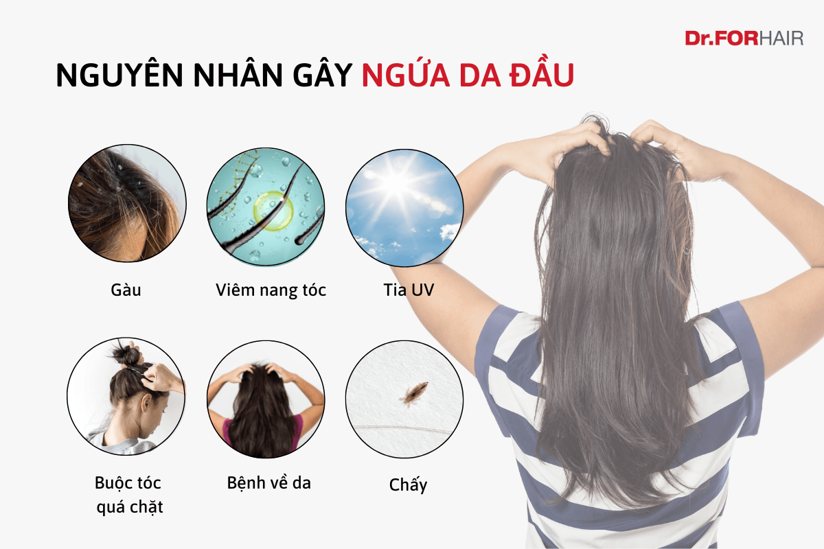 ngứa da đầu
