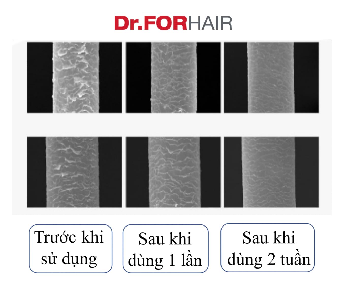 phục hồi tóc hư tổn
