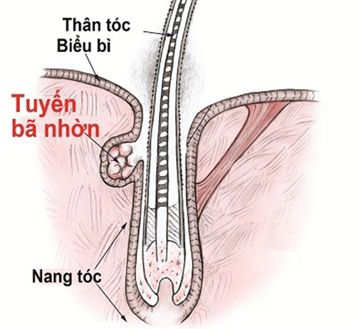 toc-dau-do-tuyen-ba-nhon-hoat-dong-qua-manh