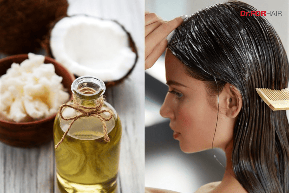 trị rụng tóc